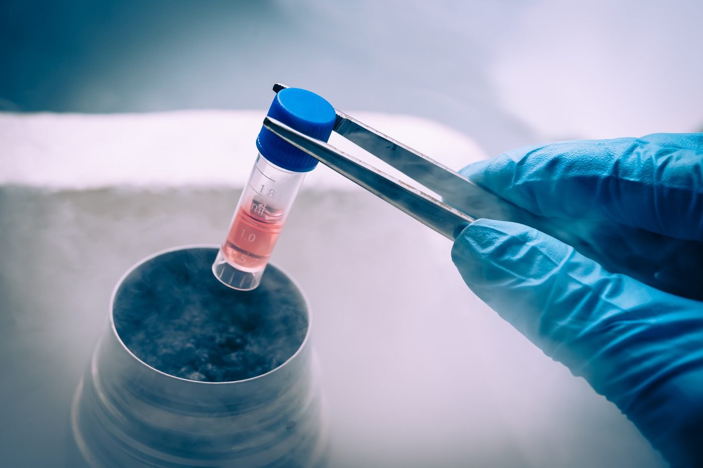 Illustration de la culture cellulaire en laboratoire, cellules souches – chirurgie esthétique Dr Smarrito