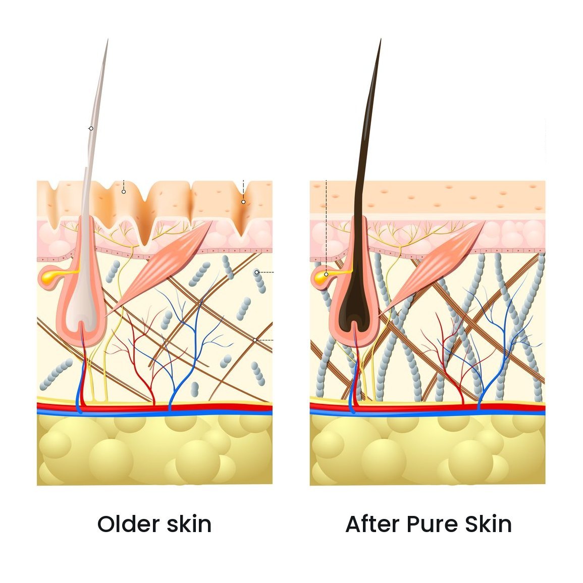 Peau âgée puis peau après Pure Skin – Pure Skin, chirurgie esthétique et médecine régénérative du Dr Smarrito