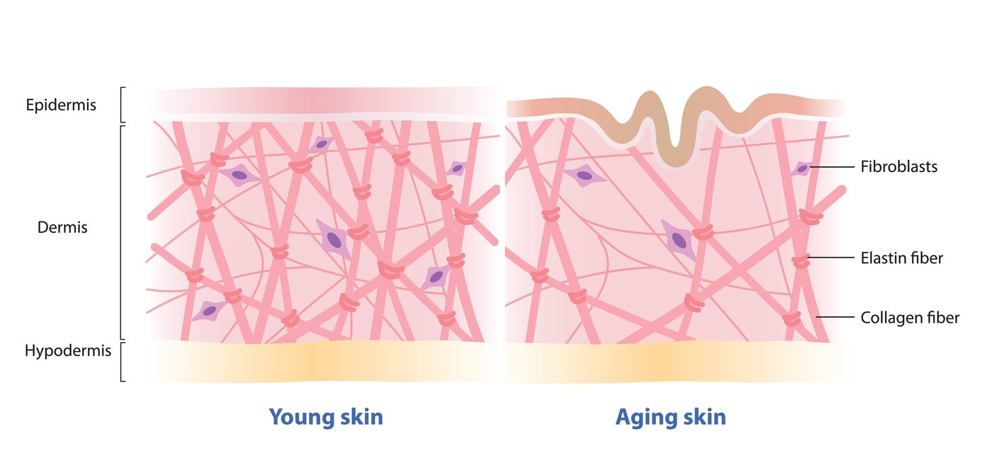 Laser thulium – médecine esthétique Dr Smarrito